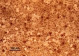 4 - Cellule corticali e tetrasporocisti in visione superficiale